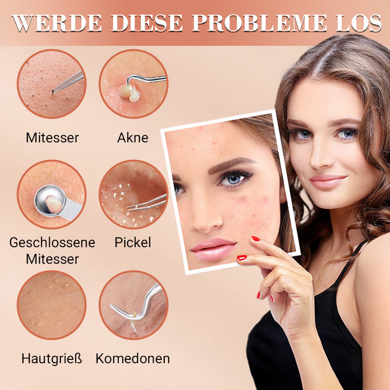 ⚡ 50% RABATT! ✨ EDELSTAHL-MITESSERENTFERNER - 7-teiliges Set für Tiefenreinigung, Präzisionswerkzeuge für Gesichtspflege, Sterilisierbar und Hautschonend 🌟🧴