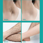 🔥  50% RABATT！！🔥Schmerzfreie Ganzkörper-Haarentfernungscreme für Männer und Frauen – Hautfreundlich für alle Körperbereiche🌿