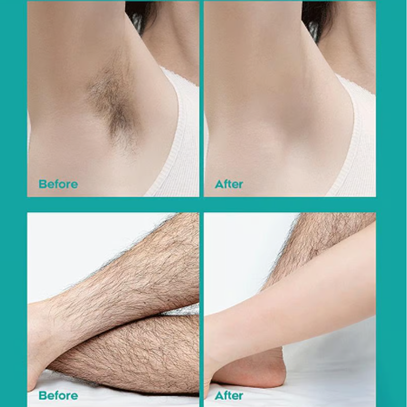 🔥  50% RABATT！！🔥Schmerzfreie Ganzkörper-Haarentfernungscreme für Männer und Frauen – Hautfreundlich für alle Körperbereiche🌿
