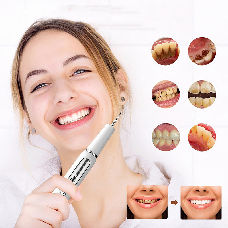 🦷 50% RABATT! ⚡ Ultraschall-Munddusche mit Elektrobetrieb – Tiefenreinigung, zahnfleischschonend & perfekt für frische Atem 💙