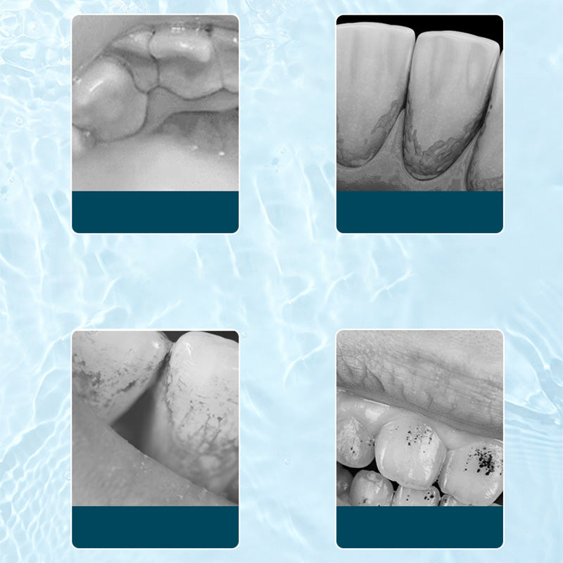 🦷 50% RABATT! ⚡ Ultraschall-Munddusche mit Elektrobetrieb – Tiefenreinigung, zahnfleischschonend & perfekt für frische Atem 💙