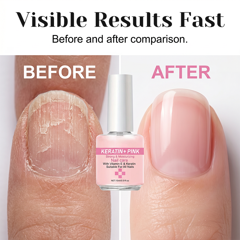 🔥50 % RABATT auf ausgewählte Produkte🎉Keratin-Nagelstärker & Feuchtigkeitsspender