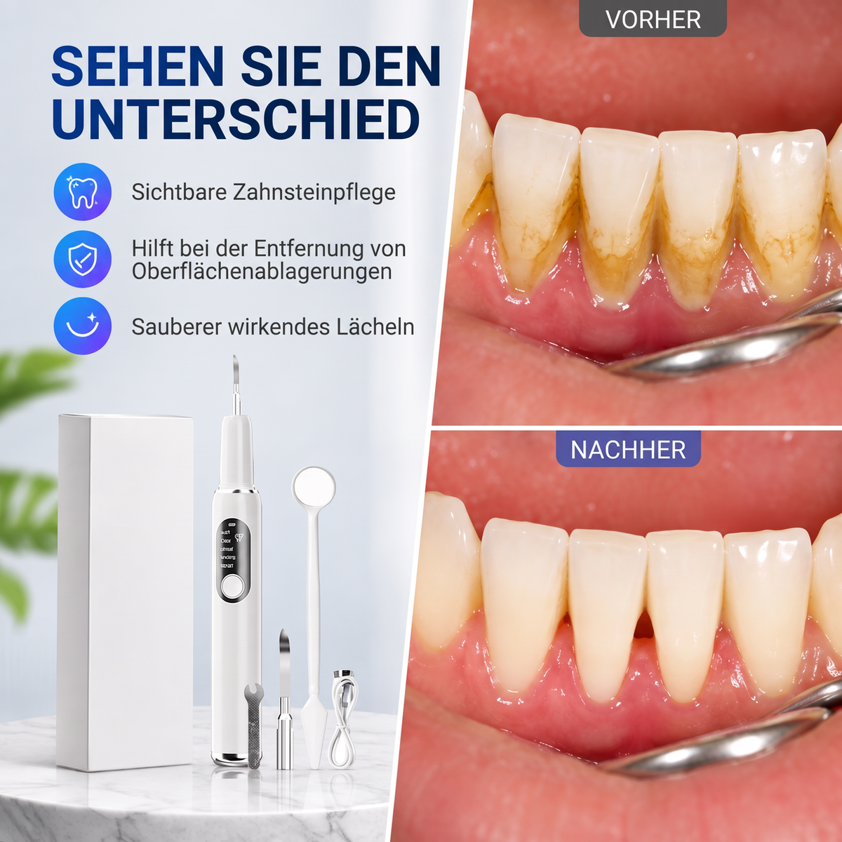 🦷✨ 50 % Rabatt! Tragbarer Ultraschall-Zahnreiniger – Zahnsteinentferner-Set für die Zahnpflege zuhause